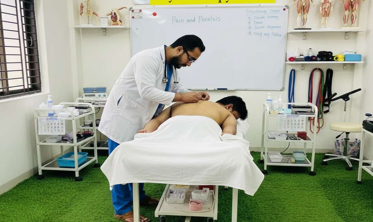 acupuncture therapy