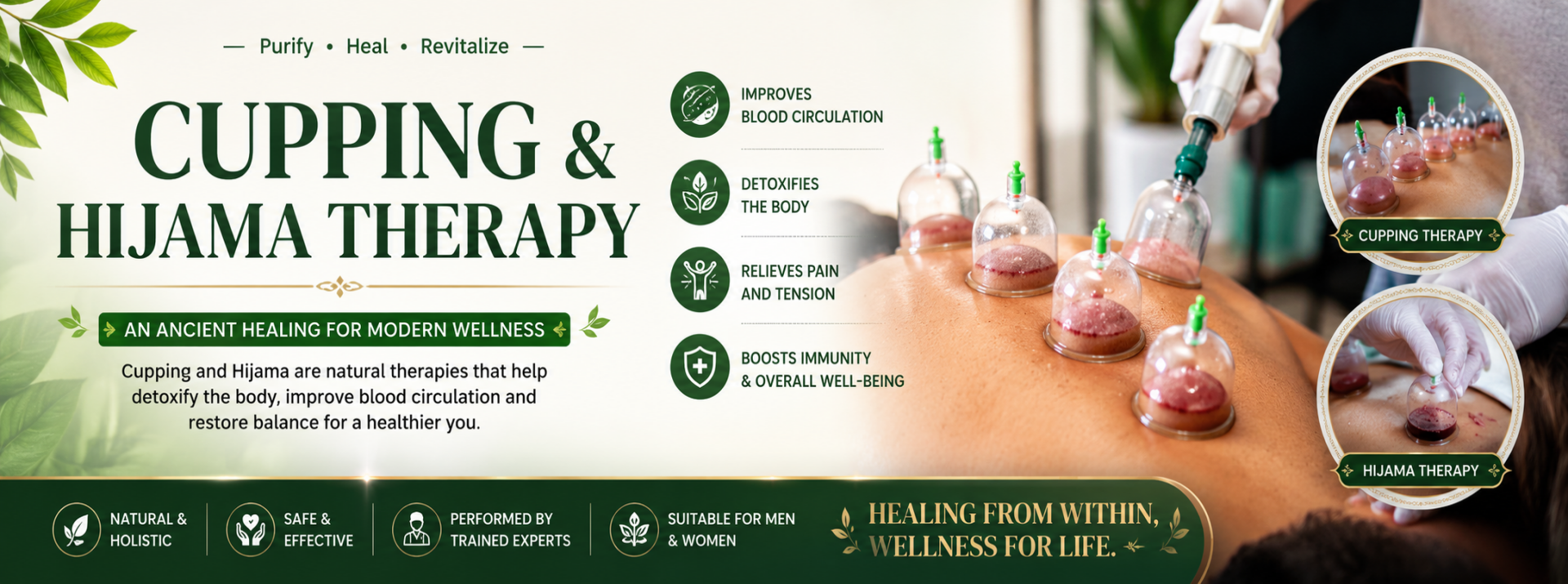 cupping and hijama therapy